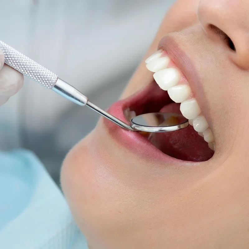 Close-up of a dentist using a dental mirror to examine a patient’s teeth during a checkup at Riverfront Dental in Cambridge Ontario