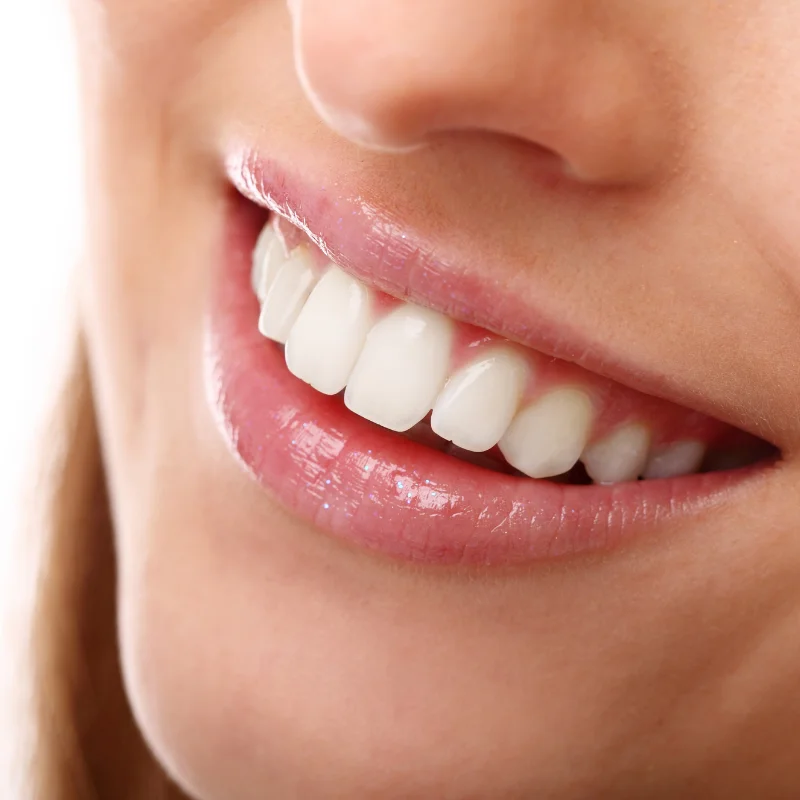 Close-up of bright white teeth and a healthy smile after professional teeth whitening at Riverfront Dental in Cambridge Ontario