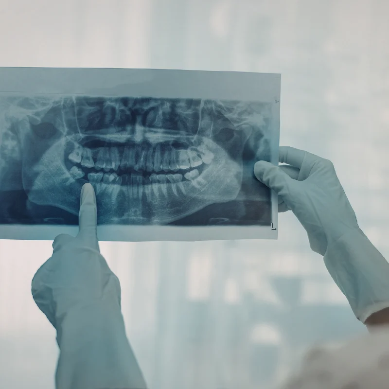 Dentist holding and examining a panoramic dental X-ray to evaluate teeth and roots during endodontic diagnosis at Riverfront Dental in Cambridge Ontario