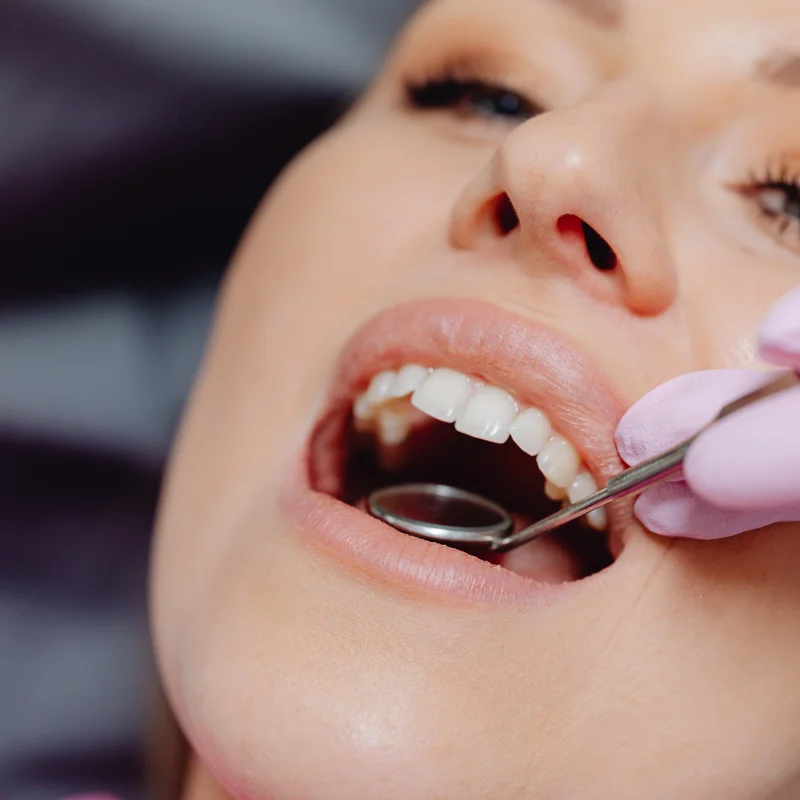 Close-up of a dentist examining a patient’s teeth with a dental mirror during an oral surgery evaluation at Riverfront Dental in Cambridge Ontario